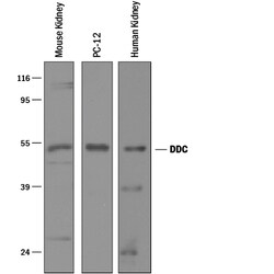 Human/Mouse/Rat Dopa Decarboxylase/DDC Antibody, R D Systems 25&mu;g; Unlabeled:Antibodies,
