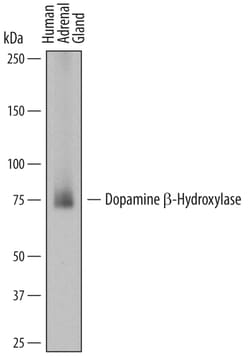 Human Dopamine beta-Hydroxylase Antibody, R D Systems 100&mu;g; Unlabeled:Antibodies,