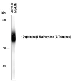 Human/Mouse/Primate Dopamine beta-Hydroxylase C-Terminus Antibody, R D