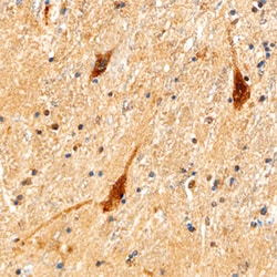 Human Dopamine D1R/DRD1 Antibody, R D Systems 25&mu;g; Unlabeled:Antibodies,