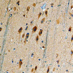 Human Dopamine D5R/DRD5 Antibody, R D Systems 100&mu;g; Unlabeled:Antibodies,