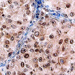 Human DOT1L Antibody, R D Systems 25&mu;g; Unlabeled:Antibodies, Monoclonal