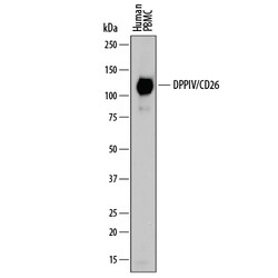 Human DPPIV/CD26 Antibody, R D Systems 25&mu;g; Unlabeled:Antibodies, Polyclonal
