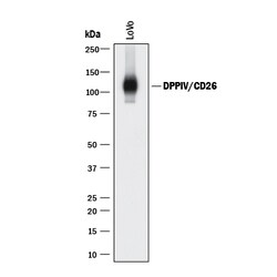 Human DPPIV/CD26 Antibody, R D Systems 25&mu;g; Unlabeled:Antibodies, Polyclonal