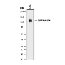 Human DPPIV/CD26 Antibody, R D Systems:Antibodies:Primary Antibodies