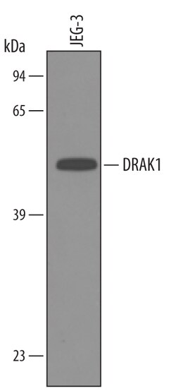 Human DRAK1 Antibody, R D Systems 25&mu;g; Unlabeled:Antibodies, Polyclonal
