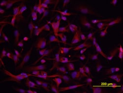 Human DSCAM Long Isoform Antibody, R D Systems 100 &mu;g | Buy Online | R&D Systems | Fisher Scientific