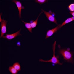 Human/Mouse Dynactin Subunit 2/DCTN2 Antibody, R D Systems 25 &mu;g | Buy Online | R&D Systems | Fisher Scientific