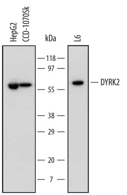 Human/Rat DYRK2 Antibody, R D Systems 100ug; Unlabeled:Antibodies, Monoclonal