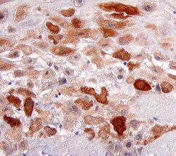 Human E2F-1 Antibody, R D Systems 100&mu;g; Unlabeled:Antibodies, Polyclonal