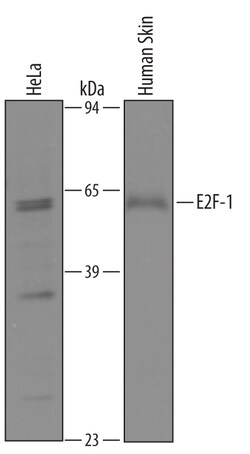 Human E2F-1 Antibody, R D Systems 100&mu;g; Unlabeled:Antibodies, Polyclonal