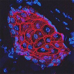 Human/Mouse E-Cadherin Antibody, R D Systems 100 &mu;g | Buy Online | R&D Systems | Fisher Scientific