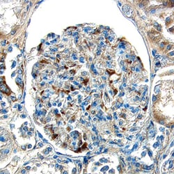 Human ECE-1 Antibody, R D Systems 100&mu;g; Unlabeled:Antibodies, Polyclonal
