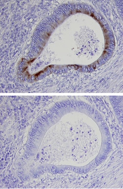 Human ECM1 Antibody, R D Systems 100&mu;g; Unlabeled:Antibodies, Polyclonal
