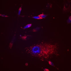 Human EDIL3 Antibody, R D Systems 25&mu;g; Unlabeled:Antibodies, Polyclonal