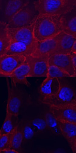 Human Phospho-EGFR (Y1173) Antibody, R D Systems 50 &mu;g | Buy Online | R&D Systems | Fisher Scientific