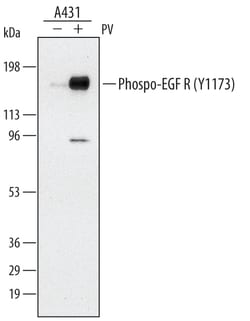 Human Phospho-EGFR (Y1173) Antibody, R D Systems 50 &mu;g | Buy Online | R&D Systems | Fisher Scientific