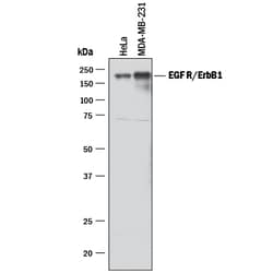 Human EGFR Antibody, R D Systems 100&mu;g; Unlabeled:Antibodies, Polyclonal