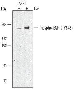 Human Phospho-EGFR (Y845) Antibody, R D Systems 50&mu;g; Unlabeled:Antibodies,