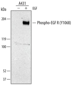 Human Phospho-EGFR (Y1068) Antibody, R D Systems 25&mu;g; Unlabeled:Antibodies,