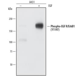 Human Phospho-EGFR (Y1197) Antibody, R D Systems 100ug; Unlabeled:Antibodies,