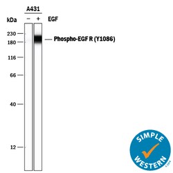 Human Phospho-EGFR (Y1086) Antibody, R D Systems:Antibodies:Primary Antibodies
