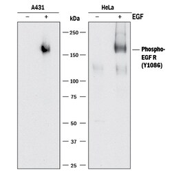 Human Phospho-EGFR (Y1086) Antibody, R D Systems:Antibodies:Primary Antibodies