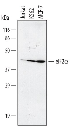 Human eIF2 alpha Antibody, R D Systems 100ug; Unlabeled:Antibodies, Monoclonal