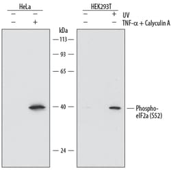 Human Phospho-eIF2 alpha (S52) Antibody, R D Systems 25&mu;g; Unlabeled:Antibodies,