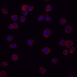 Human Endoglin/CD105 Antibody, R D Systems 100&mu;g; Unlabeled:Antibodies,