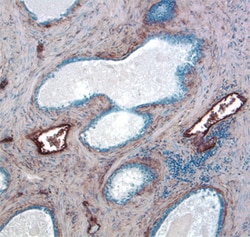 Human Endoglin/CD105 Antibody, R D Systems 100&mu;g; Unlabeled:Antibodies,