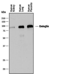 Human Endoglin/CD105 Antibody, R D Systems 100&mu;g; Unlabeled:Antibodies,