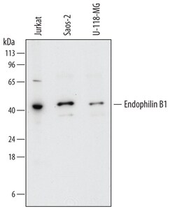 Human Endophilin B1/Bif-1 Antibody, R D Systems 25 &mu;g | Buy Online | R&D Systems | Fisher Scientific
