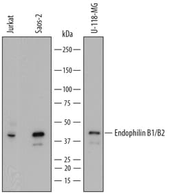 Human Endophilin B1/B2 Antibody, R D Systems 25&mu;g; Unlabeled:Antibodies,