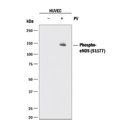 Human Phospho-eNOS (S1177) Antibody, R D Systems:Antibodies:Primary Antibodies