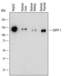 Human ENPP-1 Antibody, R D Systems 25&mu;g; Unlabeled:Antibodies, Polyclonal