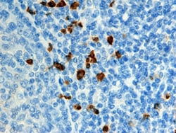 Human EN-RAGE/S100A12 Antibody, R D Systems 25&mu;g; Unlabeled:Antibodies,