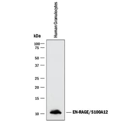 Human EN-RAGE/S100A12 Antibody, R D Systems 25&mu;g; Unlabeled:Antibodies,