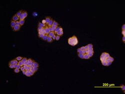 Human EpCAM/TROP-1 Antibody, R D Systems:Antibodies:Primary Antibodies