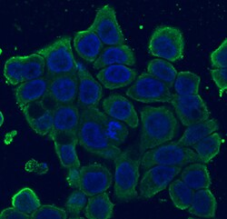 Human EpCAM/TROP-1 Antibody, R D Systems:Antibodies:Primary Antibodies