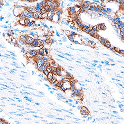 Human EpCAM/TROP-1 Antibody, R D Systems:Antibodies:Primary Antibodies