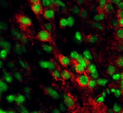 Human/Mouse EphB2 Antibody, R D Systems 25&mu;g; Unlabeled:Antibodies,