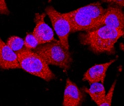 Human/Mouse EphB2 Antibody, R D Systems 100ug; Unlabeled:Antibodies, Monoclonal