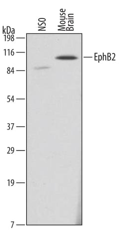 Mouse EphB2 Antibody, R D Systems 25&mu;g; Unlabeled:Antibodies, Monoclonal