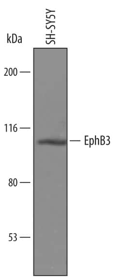 Human EphB3 Antibody, R D Systems 100&mu;g; Unlabeled:Antibodies, Polyclonal