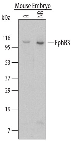 Mouse EphB3 Antibody, R D Systems 100ug; Unlabeled:Antibodies, Monoclonal