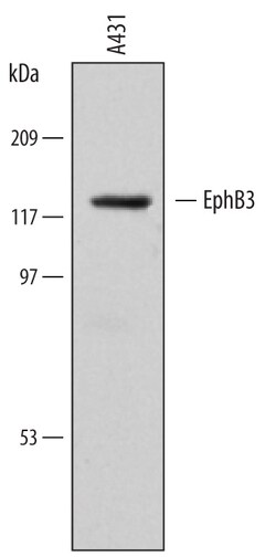 Human EphB3 Antibody, R D Systems 25&mu;g; Unlabeled:Antibodies, Monoclonal