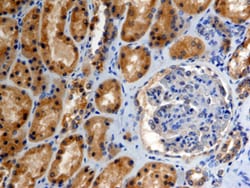 Human EphB4 Antibody, R D Systems 100&mu;g; Unlabeled:Antibodies, Polyclonal
