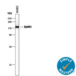Human EphB4 Antibody, R D Systems 100&mu;g; Unlabeled:Antibodies, Polyclonal