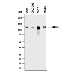 Human EphB4 Antibody, R D Systems 100&mu;g; Unlabeled:Antibodies, Polyclonal